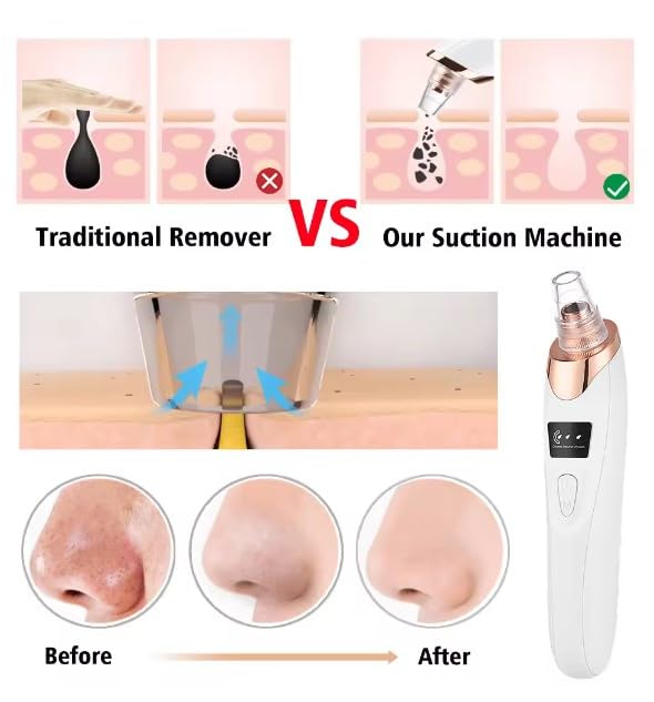Electric Blackhead Remover Vacuum with Adjustable Suction