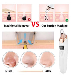 Electric Blackhead Remover Vacuum with Adjustable Suction