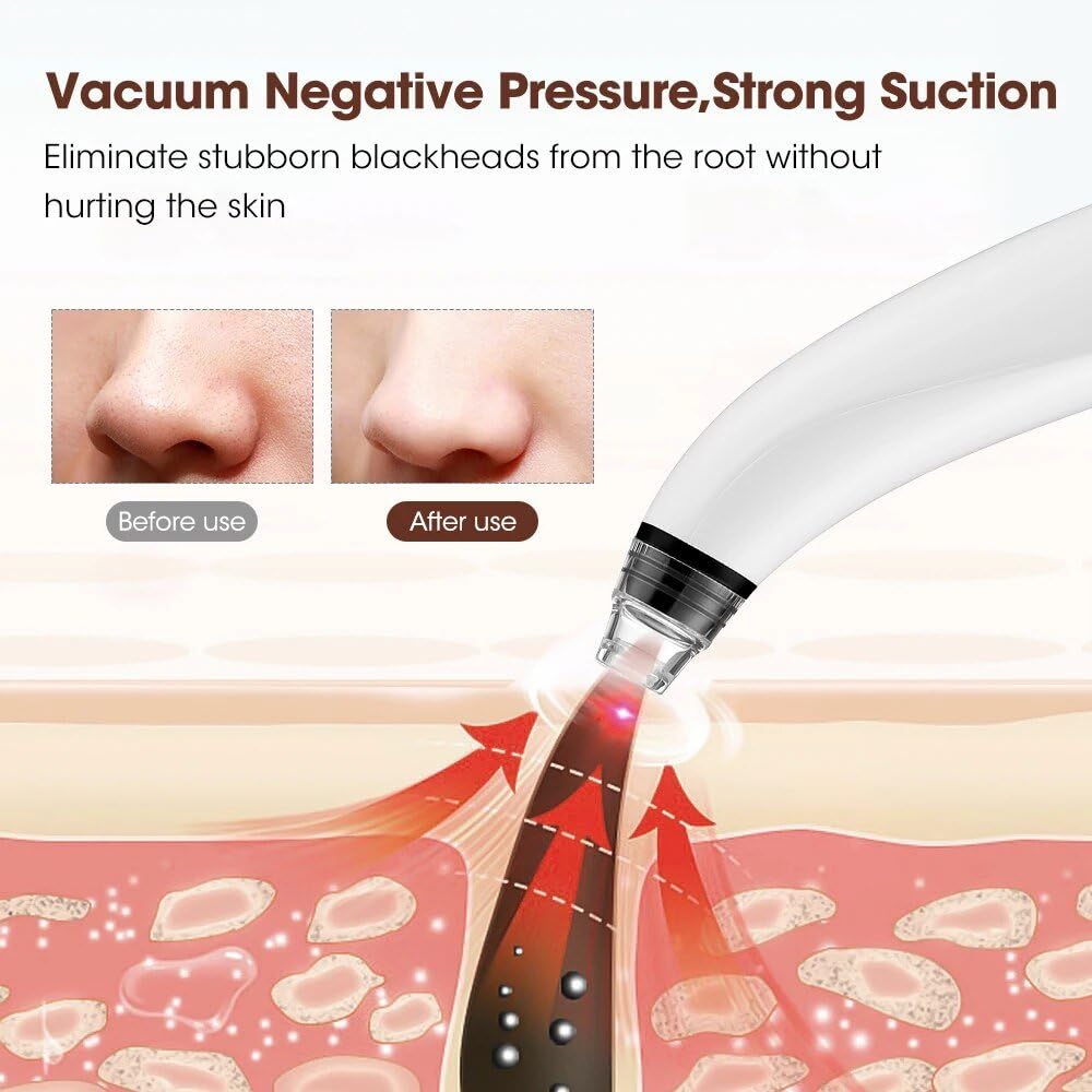 Electric Blackhead Remover Vacuum with Adjustable Suction