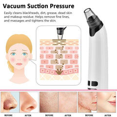 Electric Blackhead Remover Vacuum with Adjustable Suction