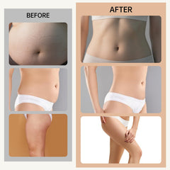 3-in-1 Body Sculpting & Skin Tightening Massager