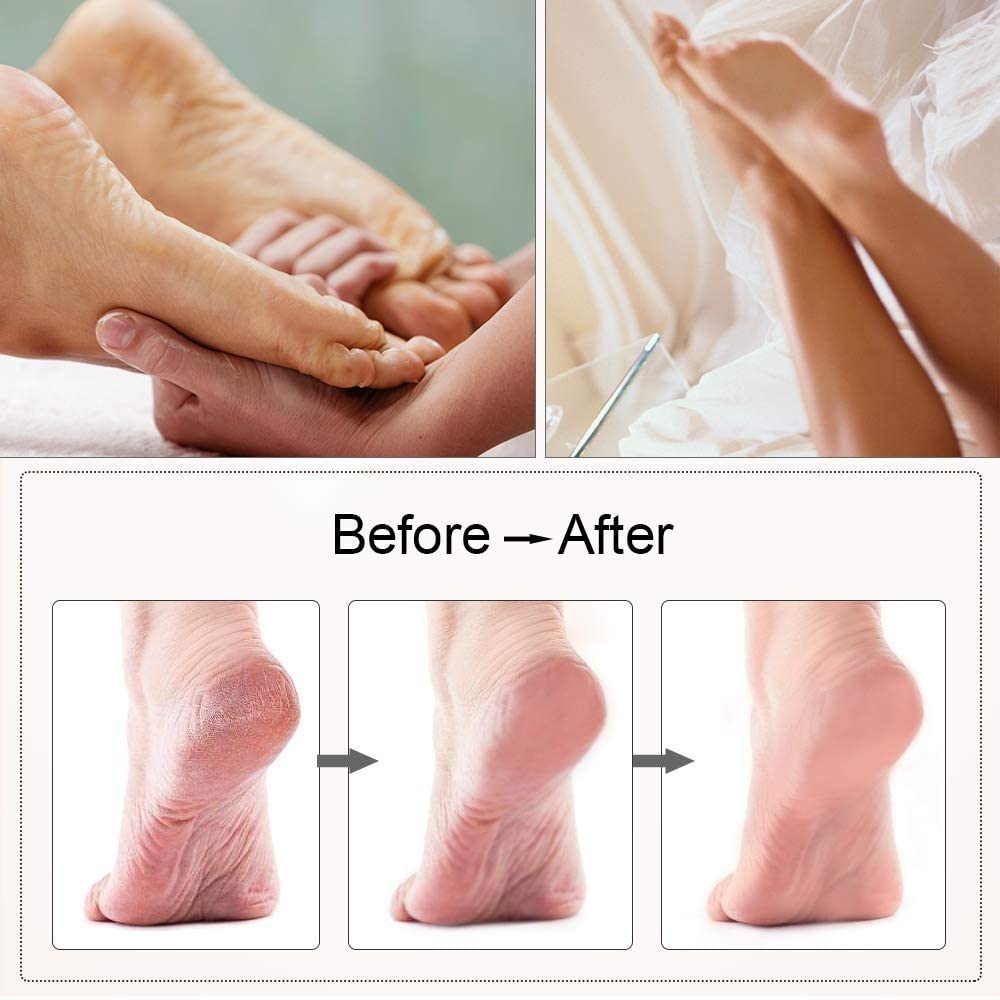 Rechargeable Electric Foot Grinder & Heel File