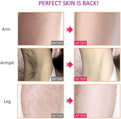 Wet & Dry Electric Epilator & Hair Trimmer