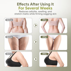 Microcurrent Body Sculpting & Lymphatic Drainage Massager